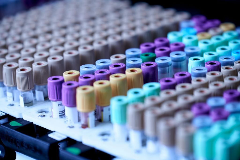 Racks of capped sample tubes in a laboratory